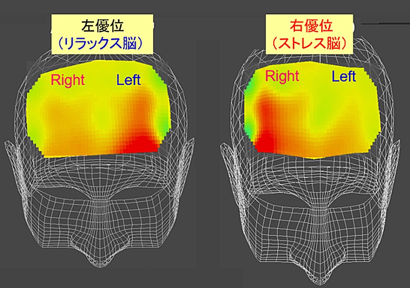 前頭葉左優位の「リラックス脳」と右優位の「ストレス脳」